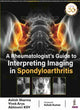 Book cover of: Rheumatologist's Guide to Interpreting Imaging in Spondyloarthritis. By: Ashish Sharma