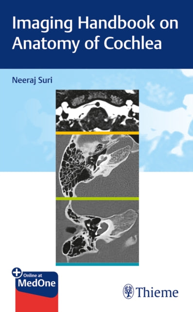 Book cover of: Imaging Handbook on Anatomy of Cochlea. By: Neeraj Suri