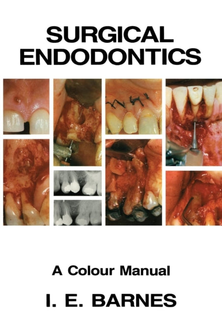 Book cover of: Surgical Endodontics. By: I. Barnes
