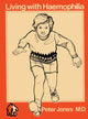 Book cover of: Living with Haemophilia. By: C. Jones