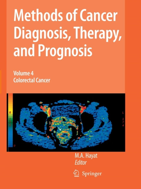 Book cover of: Methods of Cancer Diagnosis, Therapy and Prognosis. By: M. A. Hayat