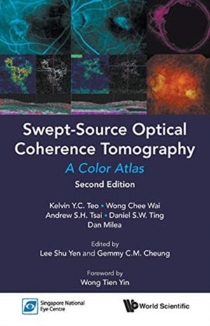 Swept-source Optical Coherence Tomography: A Color Atlas